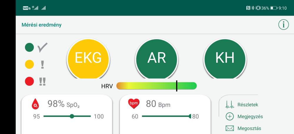 A WIWE mobil alkalmazásában megjelenő EKG mérési eredmény